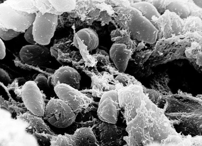 peste di Giustiniano yersinia pestis morte nera peste nera